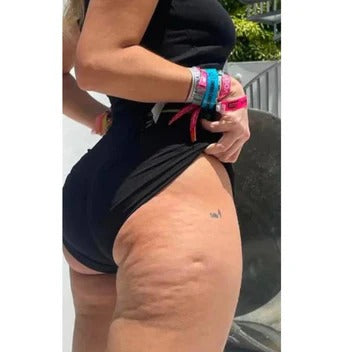 Gronata™ | Advanced Deep Fascia Cellulite Massager Gronata